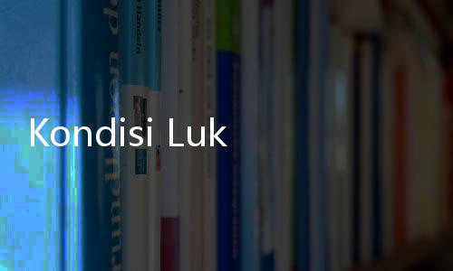 Kondisi Lukas Enembe Mulai Stabil Usai Dirawat di RSPAD, KPK Lanjutkan Pemeriksaan?